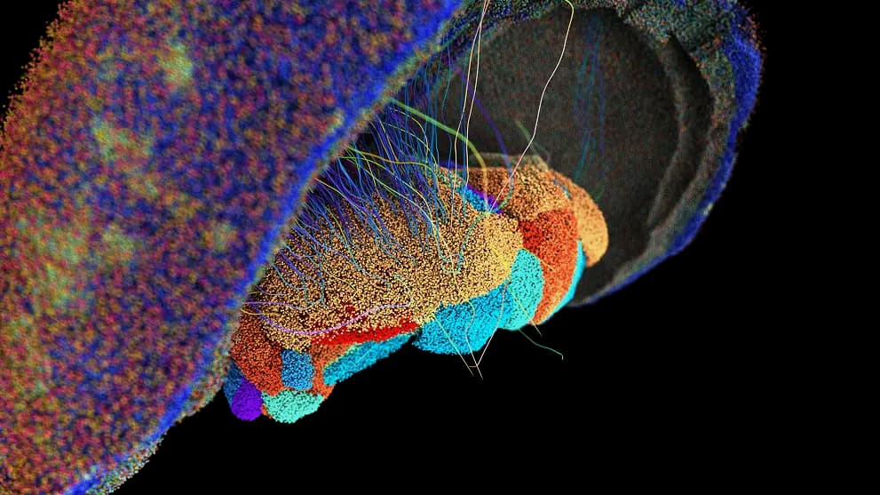 Multiple brain region image